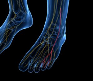 neuropathische schmerzen